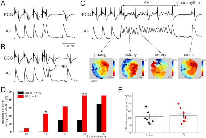 figure-results-2 Cardiac electrophysiology results, ECG/AP graphs, arrhythmia diagrams, and bar chart analysis.