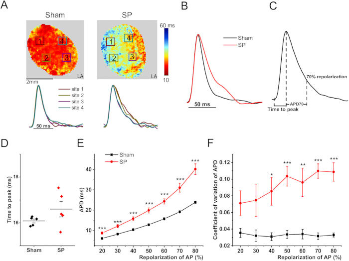 figure-results-3 Cardiac APD mapping; graphs compare Sham vs. SP groups; time to peak, repolarization data.