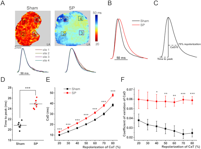 figure-results-5 Cardiac conduction analysis; diagrams/charts of Sham vs. SP conditions assessing repolarization times.
