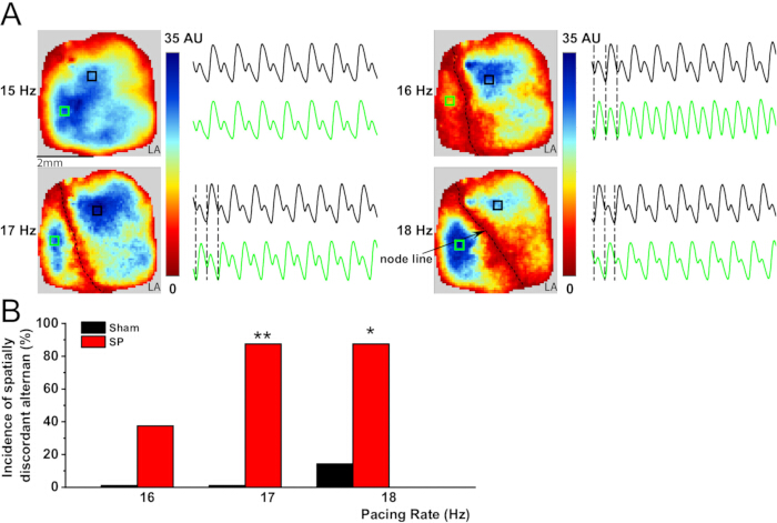 figure-results-7 Static equilibrium at varied frequencies; spatial discordance diagrams, graph; electrophysiology study.