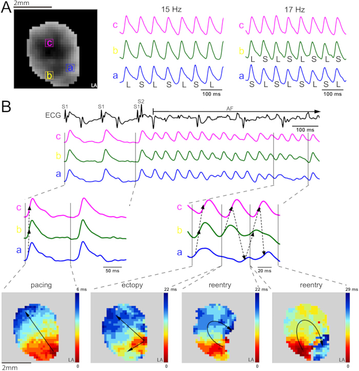 figure-results-9 Cardiac electrophysiology analysis; ECG, optical mapping; reentry, ectopy; signal mapping diagram.