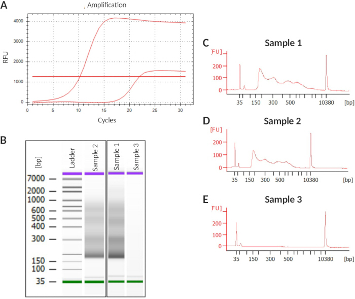 PCR amplification results; electrophoresis gel; sample analysis; DNA fragments; cycle threshold graph.