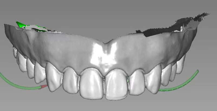 3D dental scan; orthodontic analysis; dental anatomy model; digital dentistry.