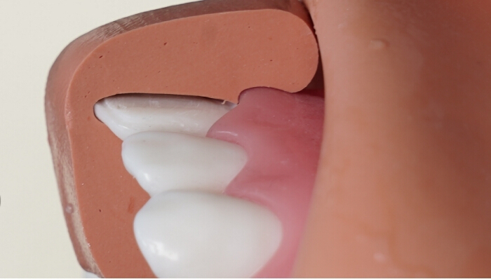 Dental model showing teeth and gum anatomy; educational diagram for dental study.