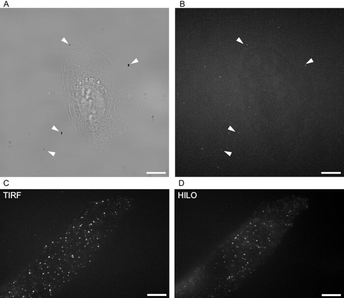 Cell imaging comparing TIRF and HILO microscopy techniques; fluorescence microscopy results.