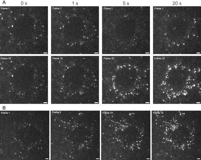 Fluorescence microscopy time-lapse; particle dynamics analysis over 20 seconds; scientific study.