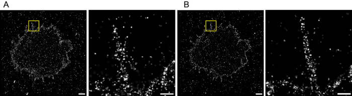 Fluorescence microscopy images of cellular structures; high-resolution details in insets.