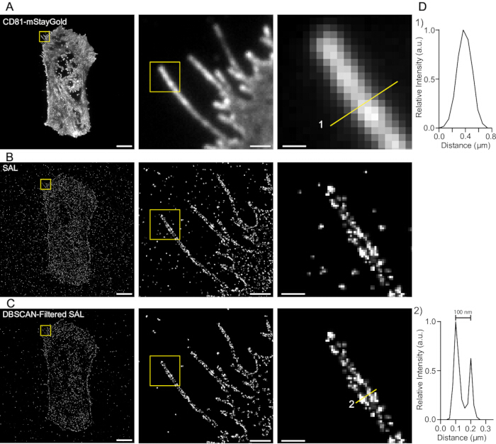CD81 protein imaging; microscopy, DBSACN-filtering; cell structure analysis; intensity graph results.