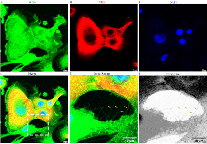 figure-results-3 Fluorescence microscopy, WGA/CK5/DAPI staining, cell structure analysis, merged channels.