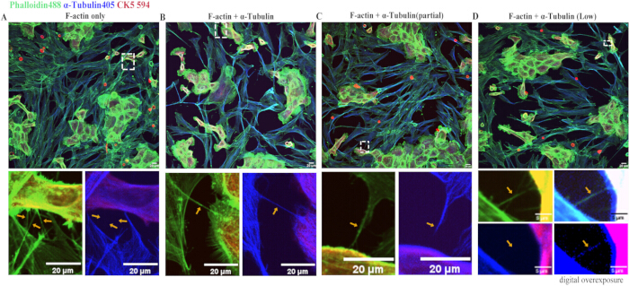 figure-results-6 Phalloidin-stained F-actin and α-Tubulin immunofluorescence microscopy, cell structural analysis.