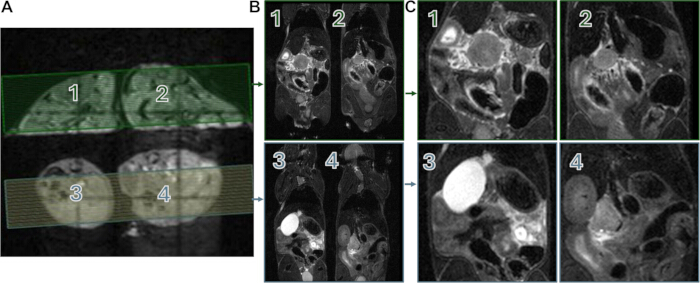 MRI cross-section analysis, tumor identification, comparative imaging, diagnostic methodology.