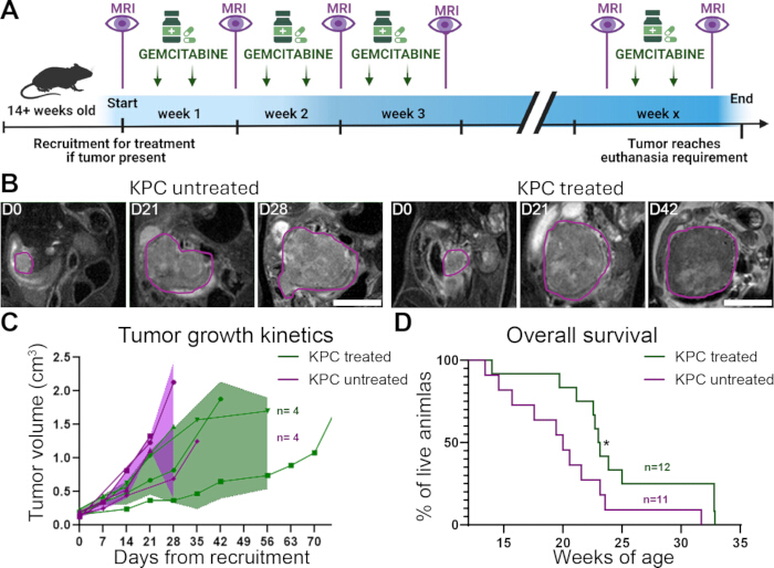 Pancreatic tumor study; MRI imaging, treatment timeline, growth kinetics graph, survival chart.