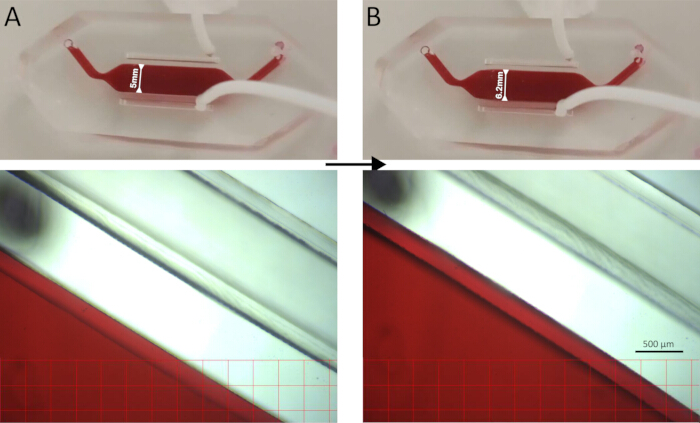 figure-results-7 Microfluidic device analysis. Diagrams showing blood flow in 5mm and 2mm channels under magnification.