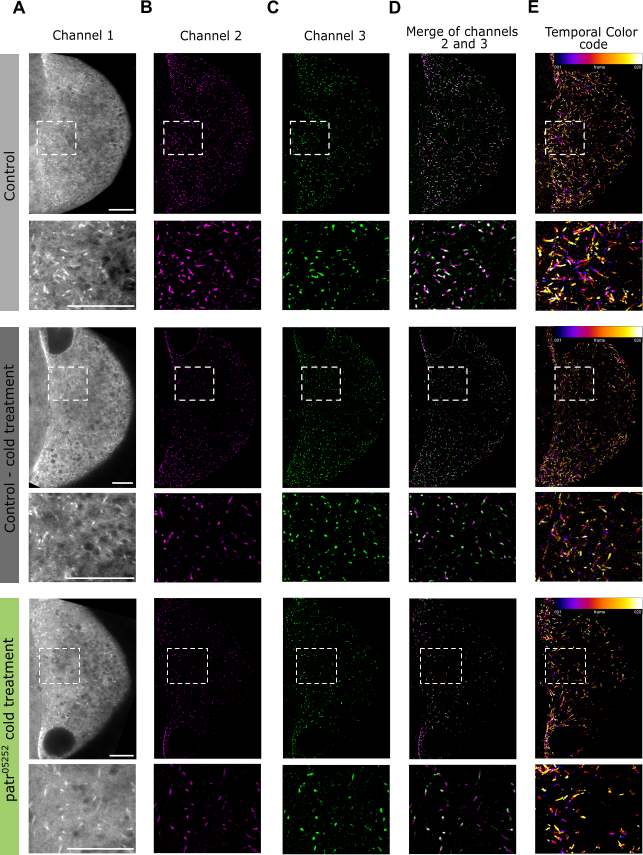 Fluorescence microscopy images; cold treatment effects on protein distribution; multi-channel merge.
