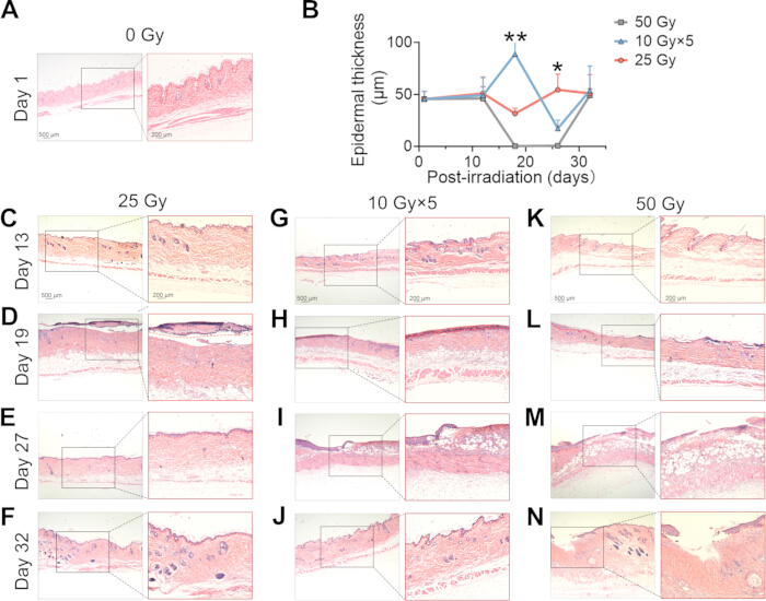 Development and Application of Radiation-Induced Skin Injury Animal ...