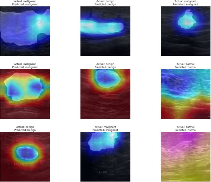 figure-protocol-19 Diagnostic accuracy heatmap; MRI scan classification; diagram; prediction vs. actual results.