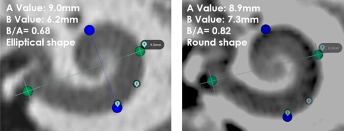 Elliptical vs. round shape comparison; grayscale diagram; area metrics; morphological analysis.