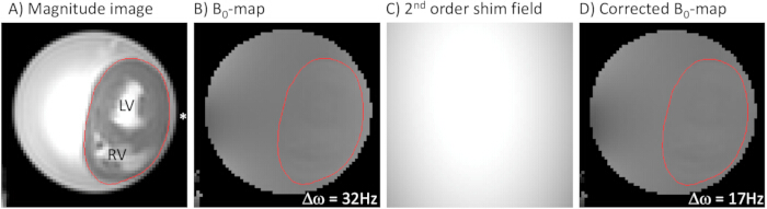 Phosphorus-31 Magnetic Resonance Spectroscopy for Serial Measurements ...