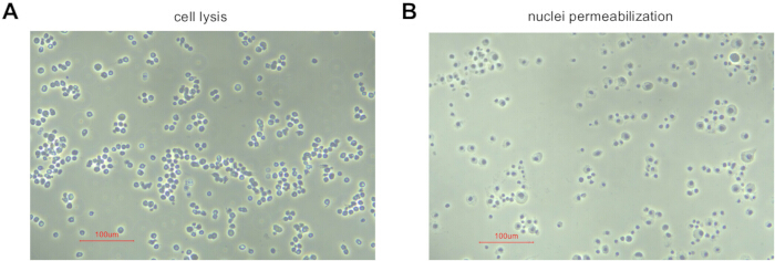 figure-results-2 cell lysis and nuclei permeabilization, microscope images, cellular biology, 100µm scale bar
