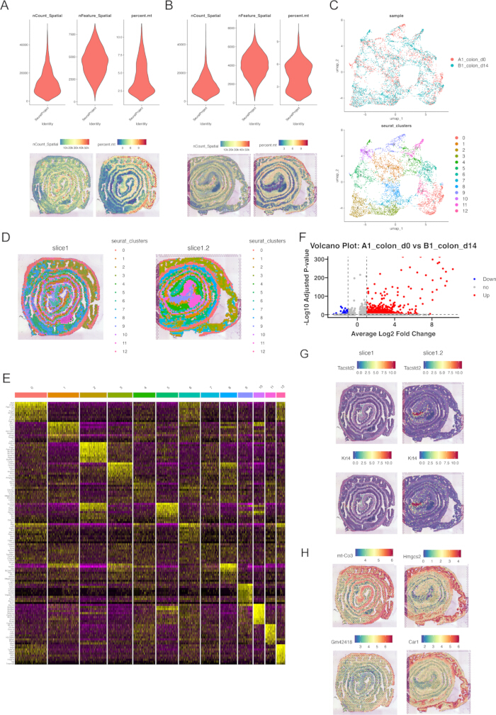figure-results-2 Spatial transcriptomics analysis with violin plots, t-SNE clustering, volcano plot, and heatmap data.