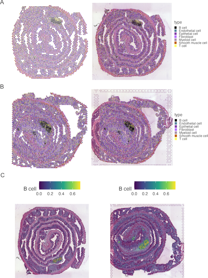 figure-results-4 Cell type distribution, microscopy images; B cell, endothelial, fibroblast analysis in tissues.