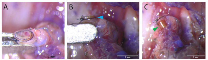 figure-protocol-2 Microsurgery procedure images; nerve manipulation shown using surgical tools; experimental technique.