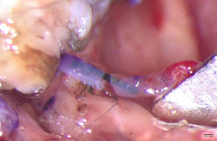 figure-protocol-4 Microscopic image; optical fiber implantation in tissue; biological experiment; detail view.