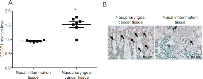 CDCP1 relative levels in nasopharyngeal vs. nasal inflammation tissue; data chart and tissue images.