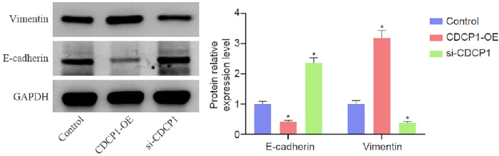 Western blot and bar graph analyzing E-cadherin and vimentin protein expression levels.
