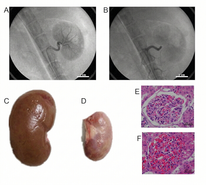 figure-results-2 Renal imaging and histology; angiography, kidney biopsy, tissue analysis for medical research.