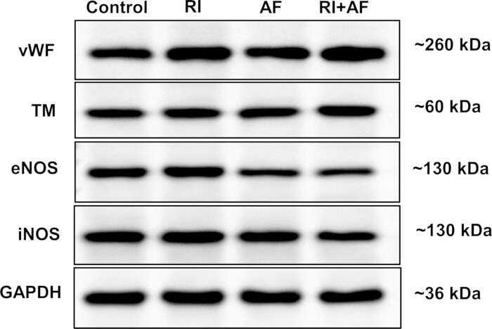 figure-results-6 Western blot analysis diagram of protein expression; vWF, TM, eNOS, iNOS, GAPDH under conditions.