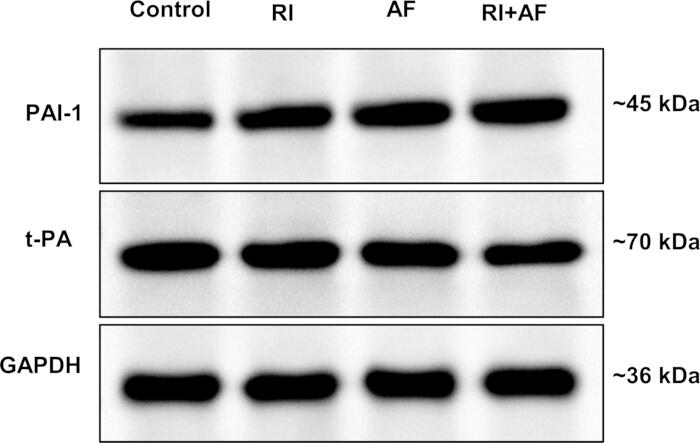 figure-results-8 Western blot analysis; protein expression, PAI-1, t-PA, GAPDH; molecular weights 45-70 kDa.