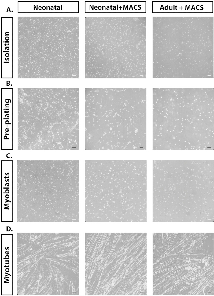 Muscle cell differentiation stages; neonatal/adult cells; myoblast to myotube; microscopy images.