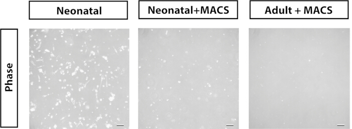 Neural cell cultures, neonatal and adult, with/without MACS, microscope image, cell density comparison.