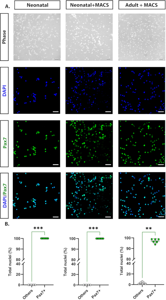 Neonatal and adult cell microscopy with DAPI/Pax7 staining, includes bar graph of nuclear percentages.