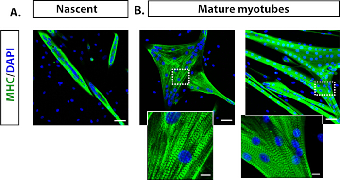 Fluorescence microscopy, MHC/DAPI-labeled nascent, mature myotubes; cellular differentiation study.