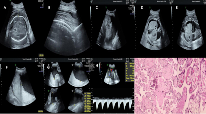Ultrasound and kidney biopsy images; diagrams for renal assessment; diagnostic imaging.