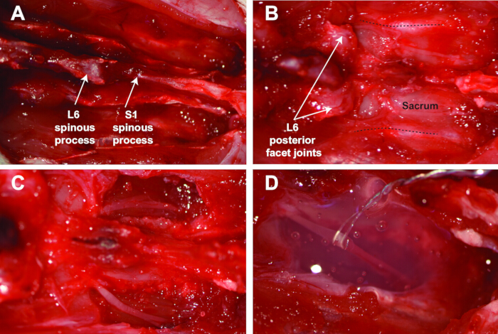 Spinal anatomy dissection showing L6 and S1 spinous processes; educational biology study.