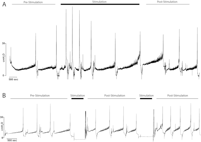 Pulmonary pressure response graph; A/B pre, stimulation, post-analysis; cmH2O vs. time; 500s.