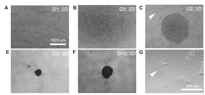 Cell culture morphological changes, 2D vs 3D development, microscopy image; scale bar 1000 μm.