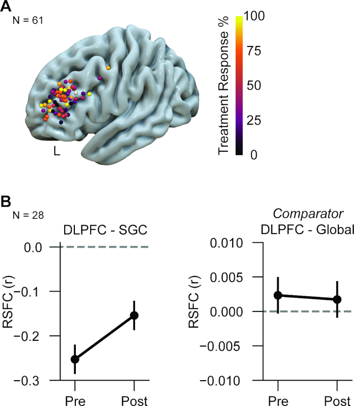 Brain response analysis; 3D brain model, response map, DLPFC RSFC graphs, pre-post comparison.