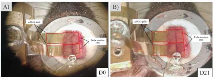 figure-results-1 µECoG grids placement on rodent skull with probe insertion sites; neural signal monitoring setup.