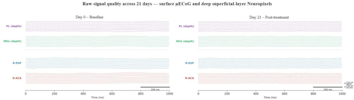 figure-results-2 Raw-signal quality graph; μECoG, Neuropixels over 21 days; baseline vs. post-treatment data.