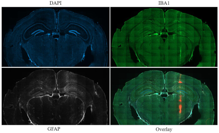 figure-results-7 Brain immunofluorescence diagram, DAPI and IBA1 staining, GFAP, overlay analysis.