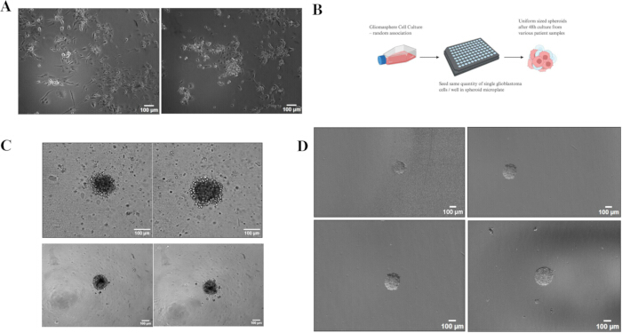 Glioblastoma cell culture images; method diagram; microscope spheroid formation analysis.