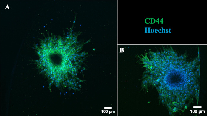 Fluorescence microscopy image of CD44 protein expression and Hoechst DNA staining on cells.