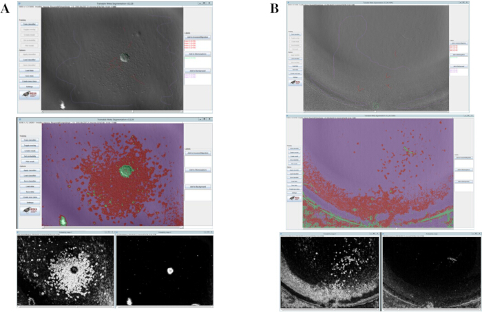 Electron microscopy image analysis; particle distribution; diagram; microscopy software interface.