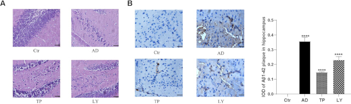 Histology images of hippocampus in control, AD, TP, LY groups with Aβ1-42 plaque quantification chart.