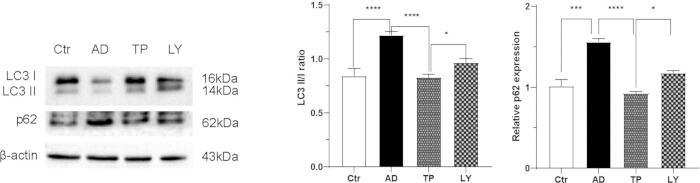 Western blot and bar graphs for LC3, p62 expression; protein analysis in cell samples.
