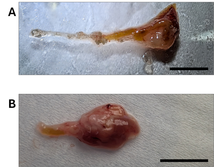 Debridement process; two dissected chicken embryo hearts; anatomical comparison; labeled A and B.